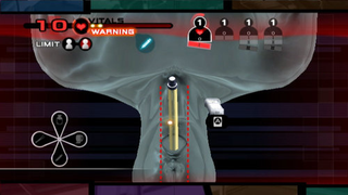 Illustration for article titled Clear The Way For New Trauma Team Screens
